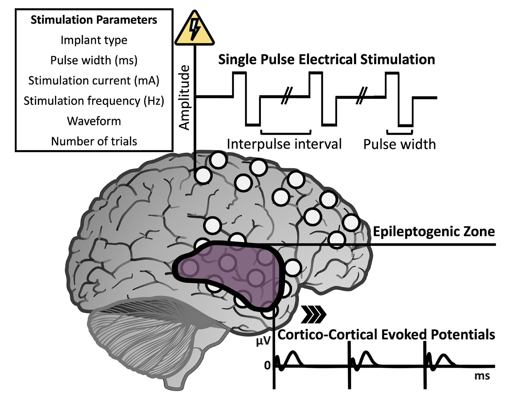 diagram of a brain with stimulation points and waveform of currents applied