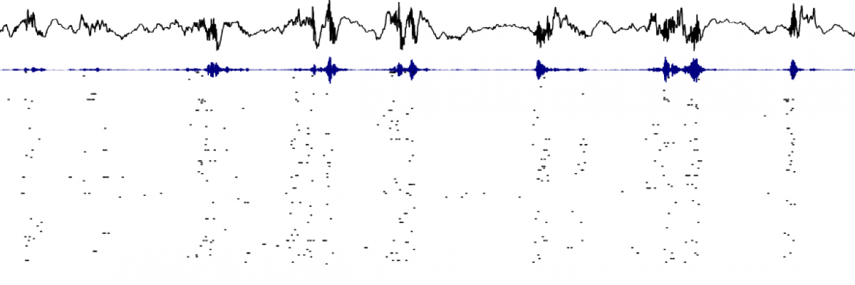 plots of brain activity and individual neurons firing